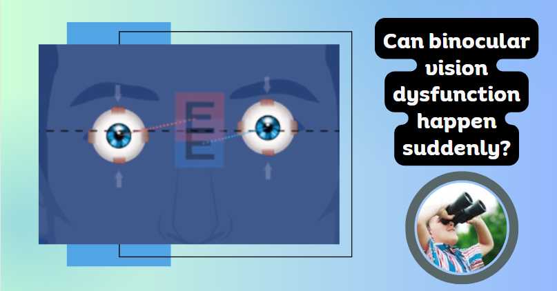 Can binocular vision dysfunction happen suddenly
