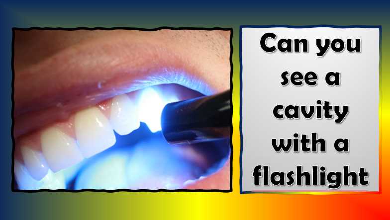 Can you see a cavity with a flashlight