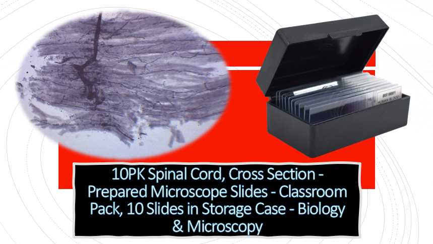10PK Spinal Cord, Cross Section - Prepared Microscope Slides - Classroom Pack, 10 Slides in Storage Case - Spinal Cord Microscope Slide Labeled