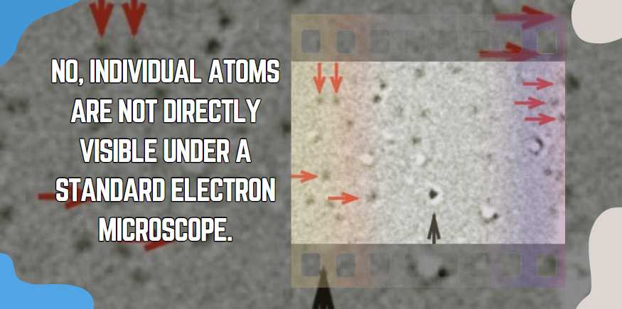 No, individual atoms are not directly visible under a standard electron microscope.